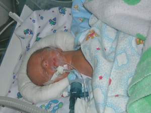 Сейчас в инкубаторе врачи выхаживают мальчика, родившегося с весом 1 кг 600 г. Несмотря на то, что ребенок далеко не 500-грам- мовый, новое оборудование - единственный шанс сохранить ему жизнь